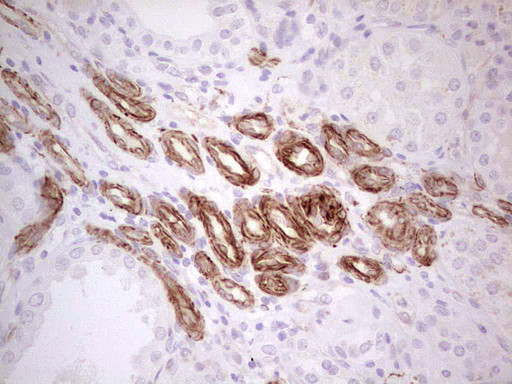 SYNM Antibody in Immunohistochemistry (Paraffin) (IHC (P))