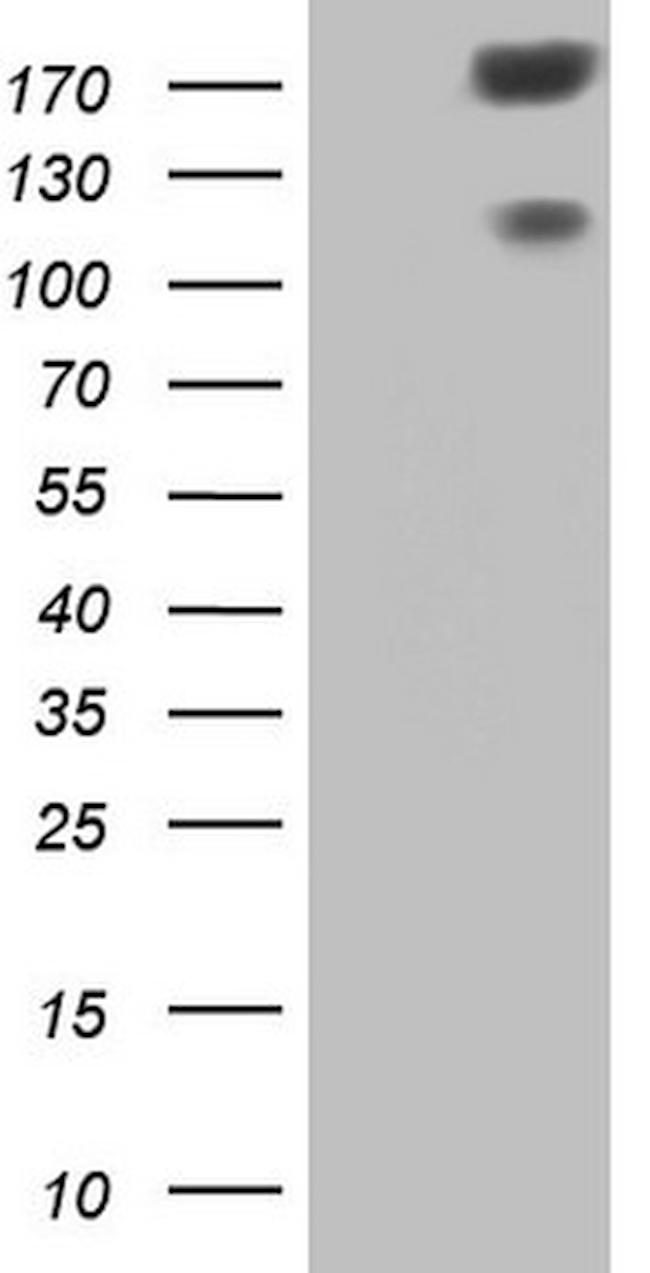 SYNM Antibody in Western Blot (WB)