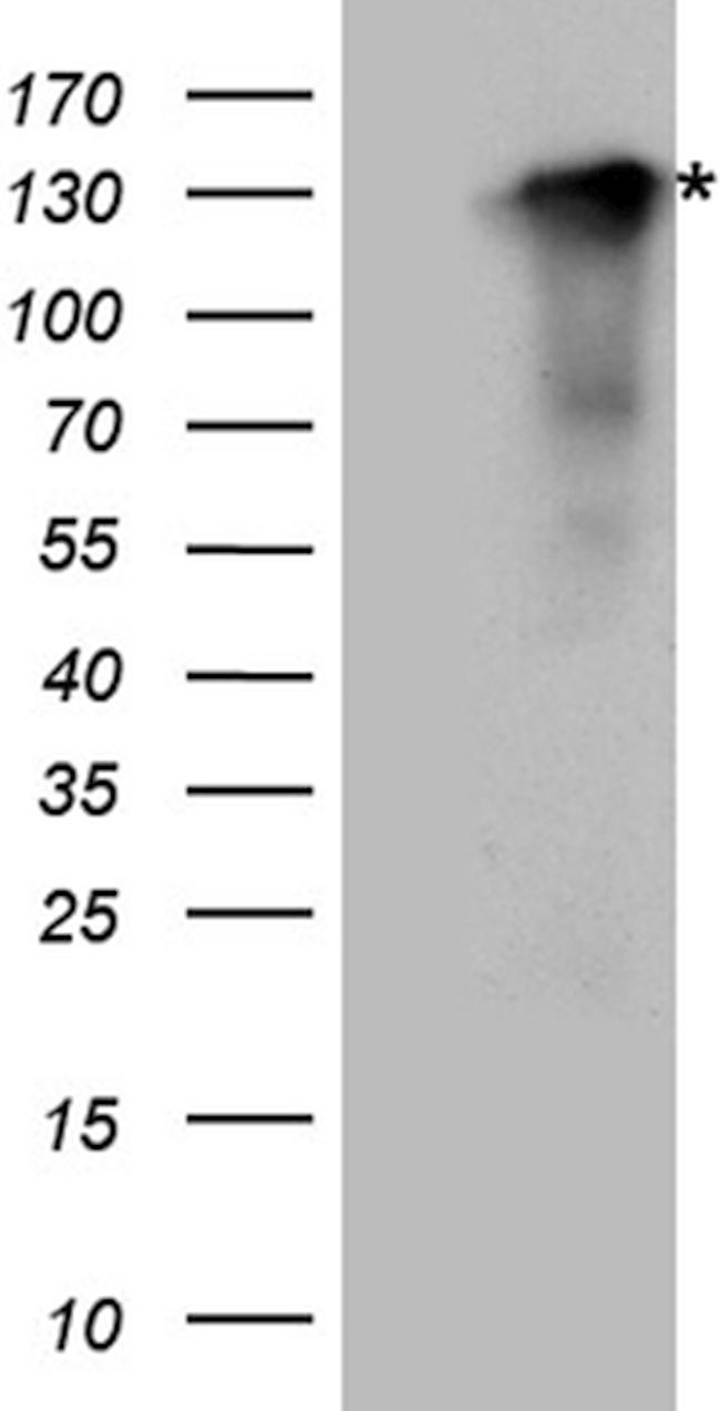 SYNPO Antibody in Western Blot (WB)