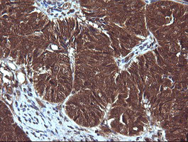 SYP Antibody in Immunohistochemistry (Paraffin) (IHC (P))