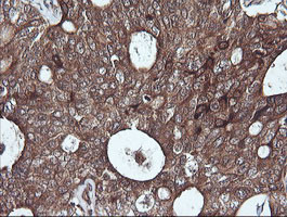 SYP Antibody in Immunohistochemistry (Paraffin) (IHC (P))