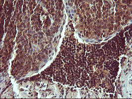 SYP Antibody in Immunohistochemistry (Paraffin) (IHC (P))