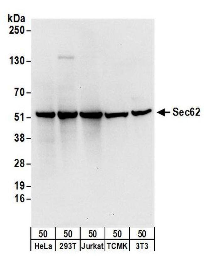 Sec62 Antibody in Western Blot (WB)