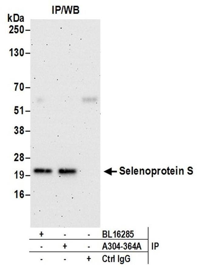Selenoprotein S Antibody in Western Blot (WB)