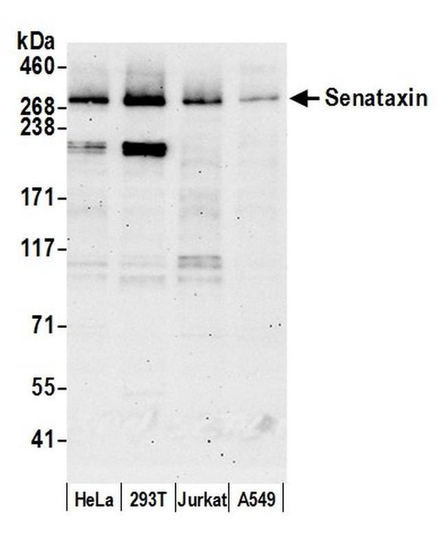 Senataxin Antibody in Western Blot (WB)