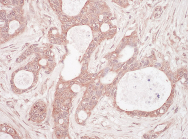 Sequestosome-1 Antibody in Immunohistochemistry (IHC)