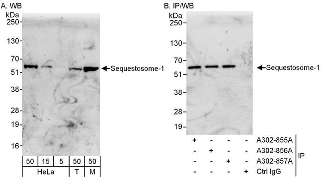 Sequestosome-1 Antibody in Western Blot (WB)