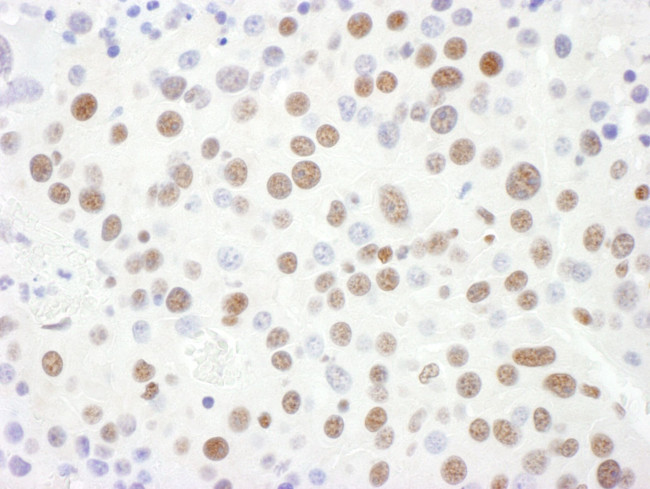 Sm-D3 Antibody in Immunohistochemistry (IHC)