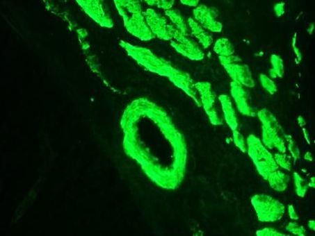 Smoothelin Antibody in Immunohistochemistry (Frozen) (IHC (F))