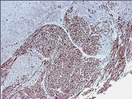 Smoothelin Antibody in Immunohistochemistry (Paraffin) (IHC (P))