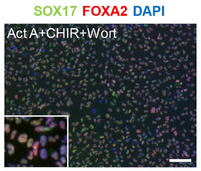 Sox17 Antibody in Immunocytochemistry (ICC/IF)