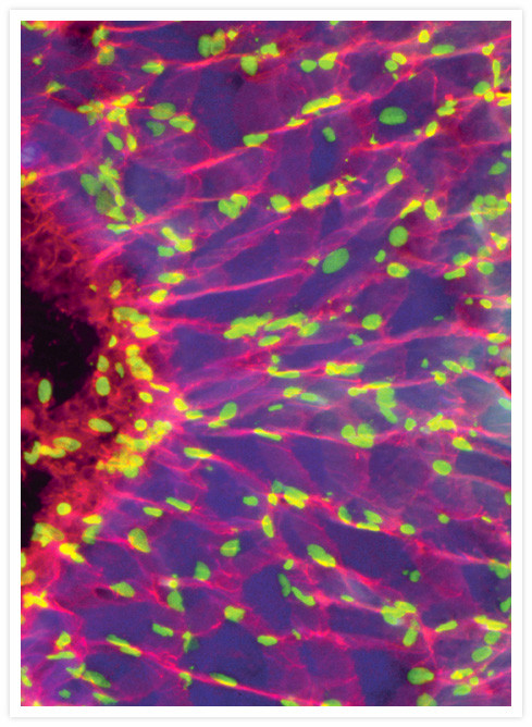 Mouse IgG (H+L) Cross-Adsorbed Secondary Antibody in Immunohistochemistry (IHC)