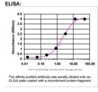 AIP/ARA9 Antibody in ELISA (ELISA)