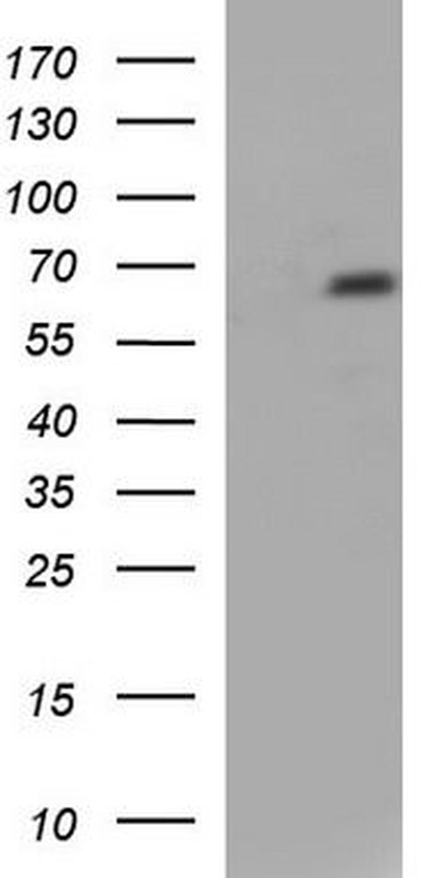 LIM kinase 2 Antibody in Western Blot (WB)