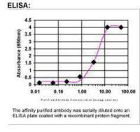 CEP290 Antibody in ELISA (ELISA)
