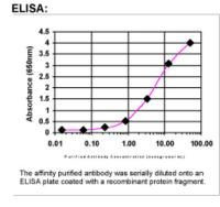 LMTK2 Antibody in ELISA (ELISA)