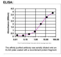 STARD3 Antibody in ELISA (ELISA)