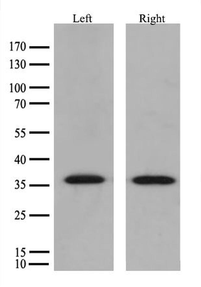 HSD17B13 Antibody in Western Blot (WB)