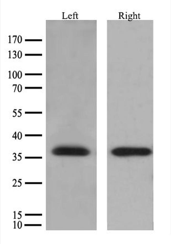 HSD17B13 Antibody in Western Blot (WB)