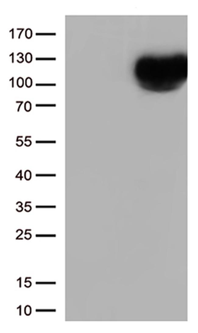 CD10 (MME) Antibody in Western Blot (WB)