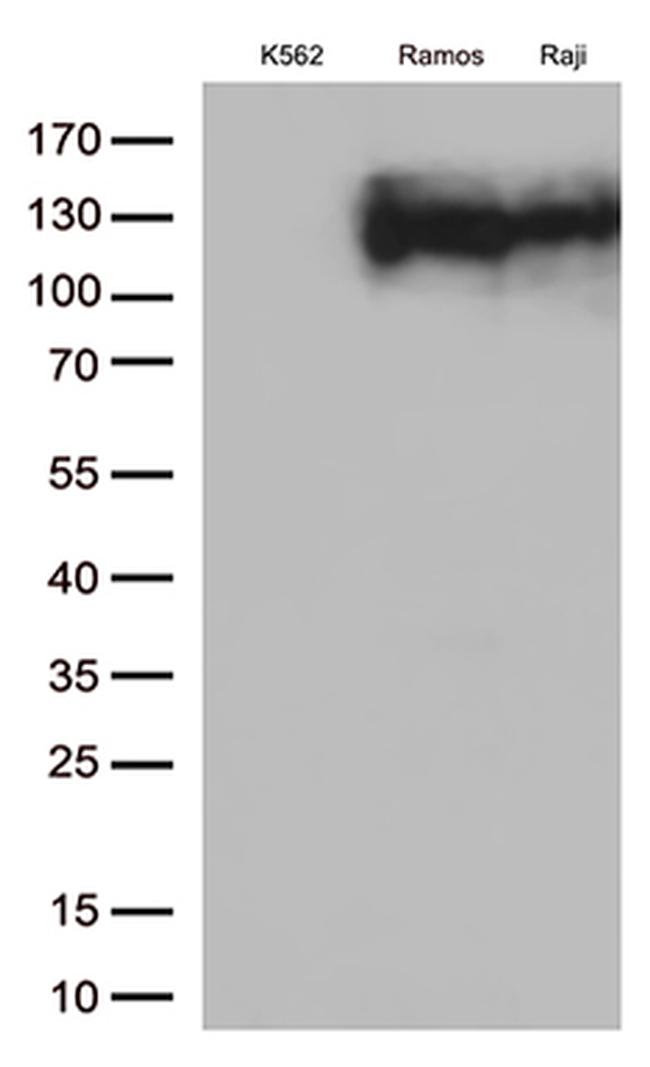 CD10 (MME) Antibody in Western Blot (WB)