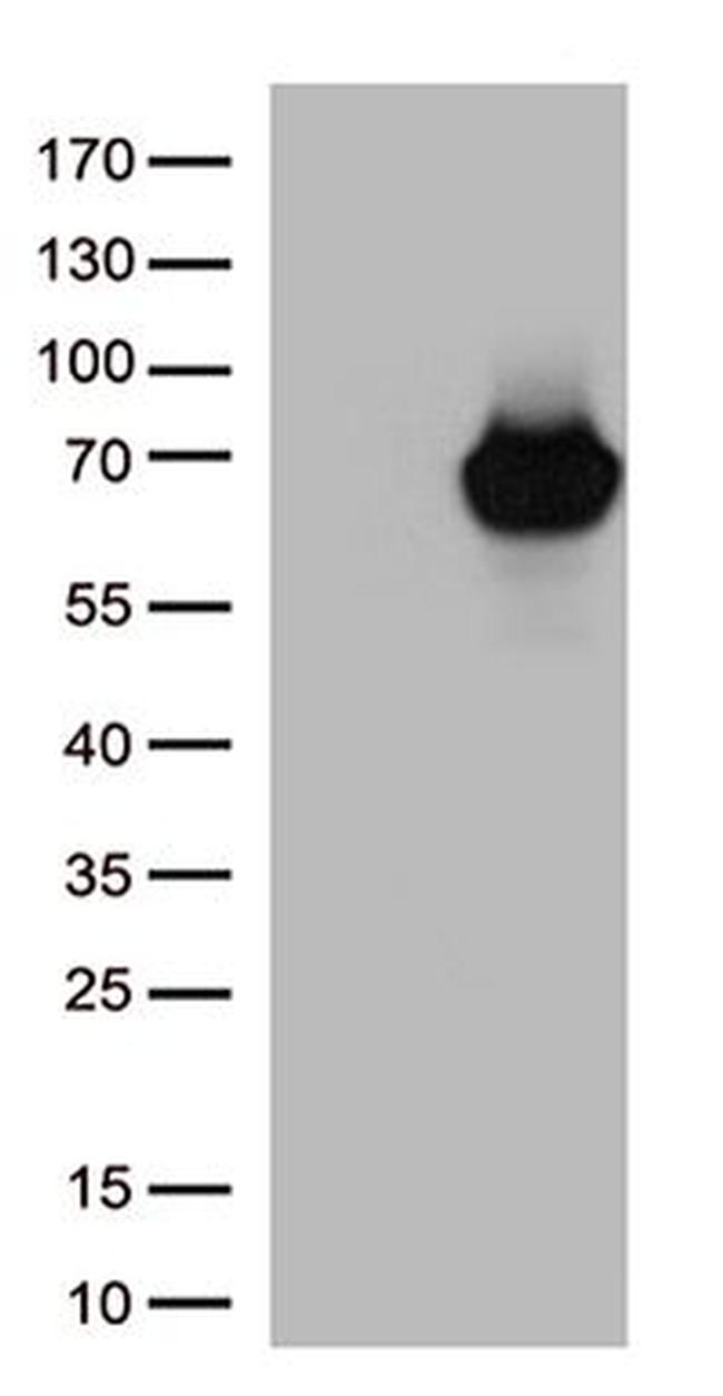 ARSB Antibody in Western Blot (WB)