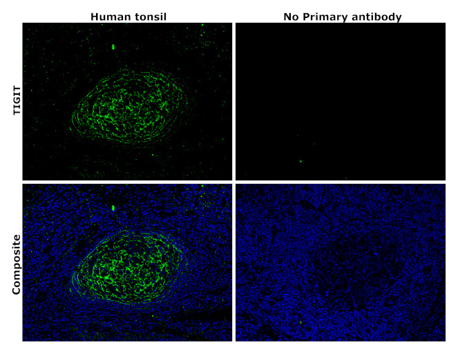TIGIT Monoclonal Antibody (OTI8G7), TrueMAB™