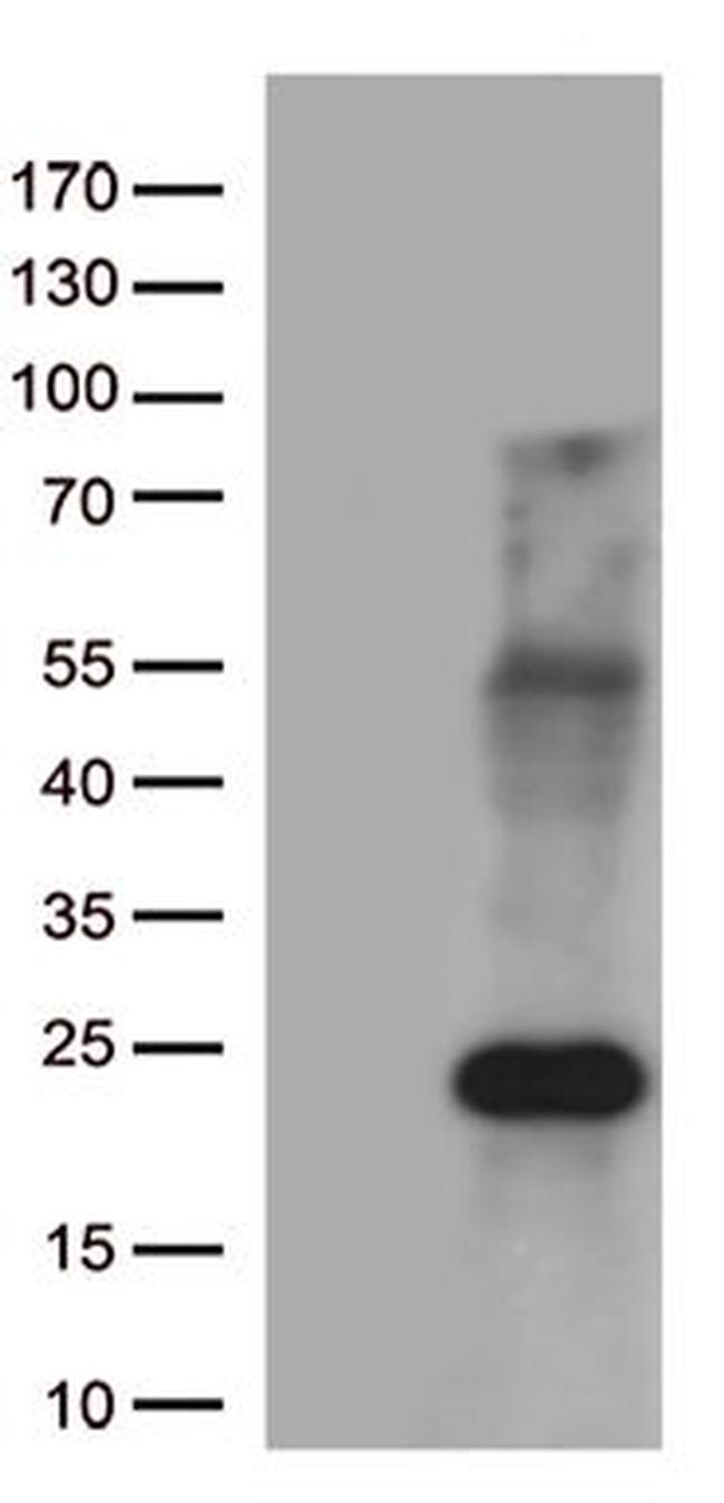 MYL9 Antibody in Western Blot (WB)