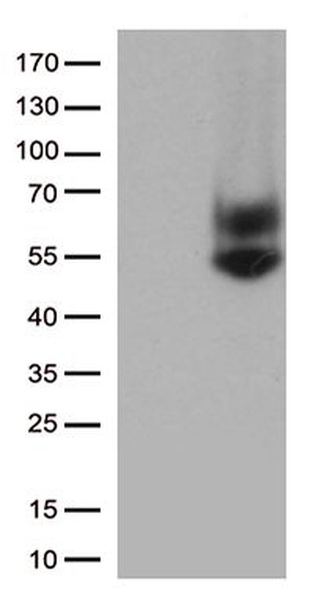 FCGR3A Antibody in Western Blot (WB)