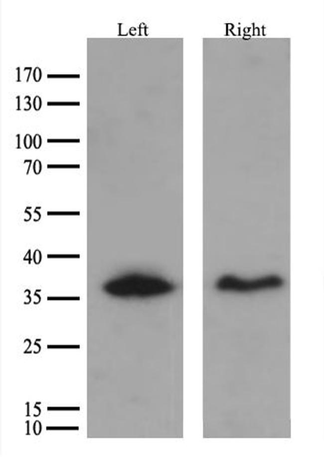 HSD17B13 Antibody in Western Blot (WB)