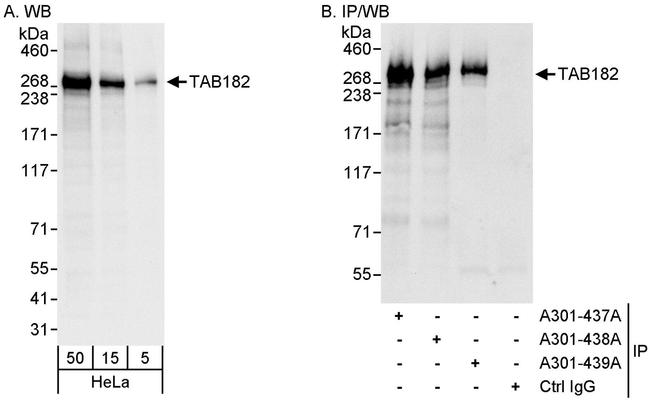 TAB182 Antibody in Western Blot (WB)