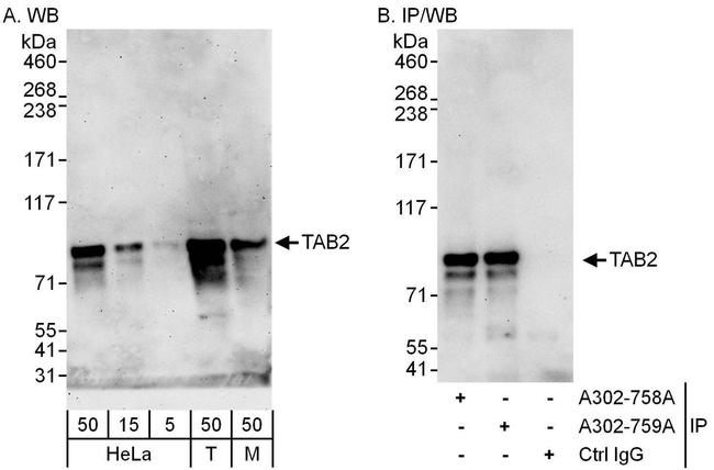 TAB2 Antibody in Western Blot (WB)