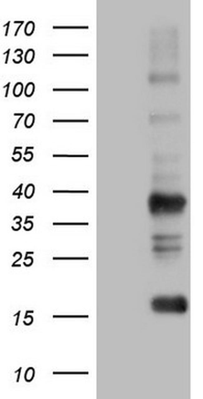 TACC2 Antibody in Western Blot (WB)