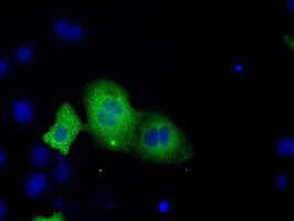 TACC3 Antibody in Immunocytochemistry (ICC/IF)