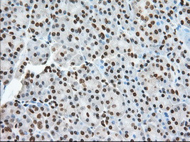 TACC3 Antibody in Immunohistochemistry (Paraffin) (IHC (P))