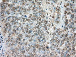 TACC3 Antibody in Immunohistochemistry (Paraffin) (IHC (P))