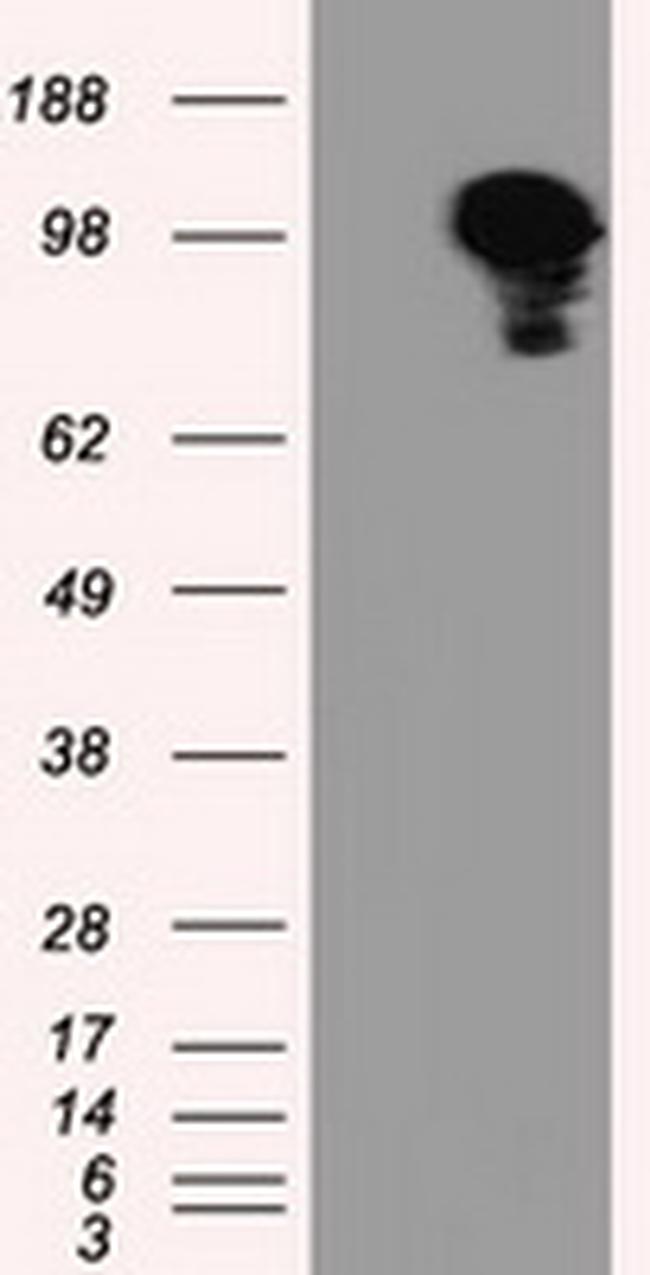 TACC3 Antibody in Western Blot (WB)
