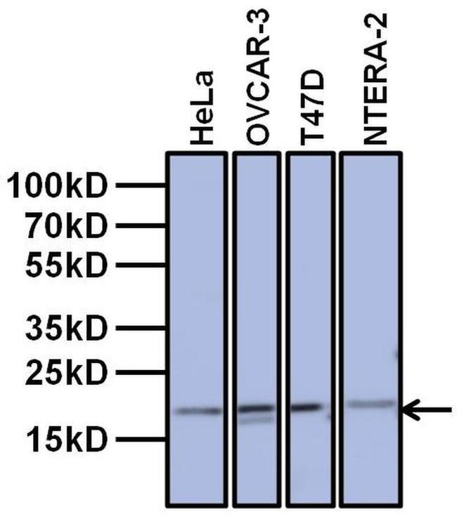 TAF12 Antibody in Western Blot (WB)