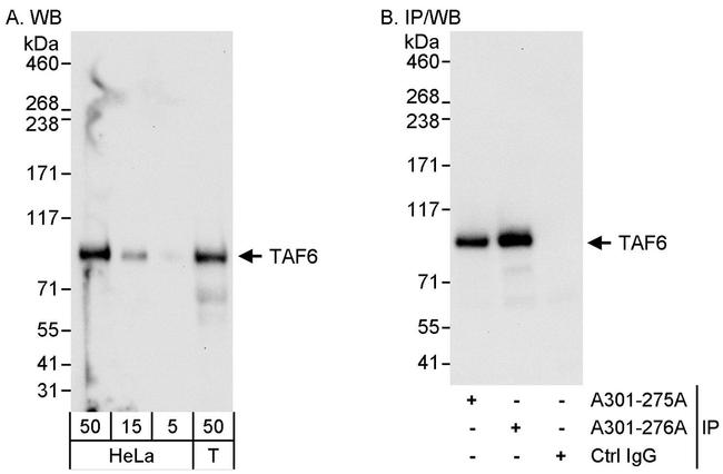TAF6 Antibody in Western Blot (WB)