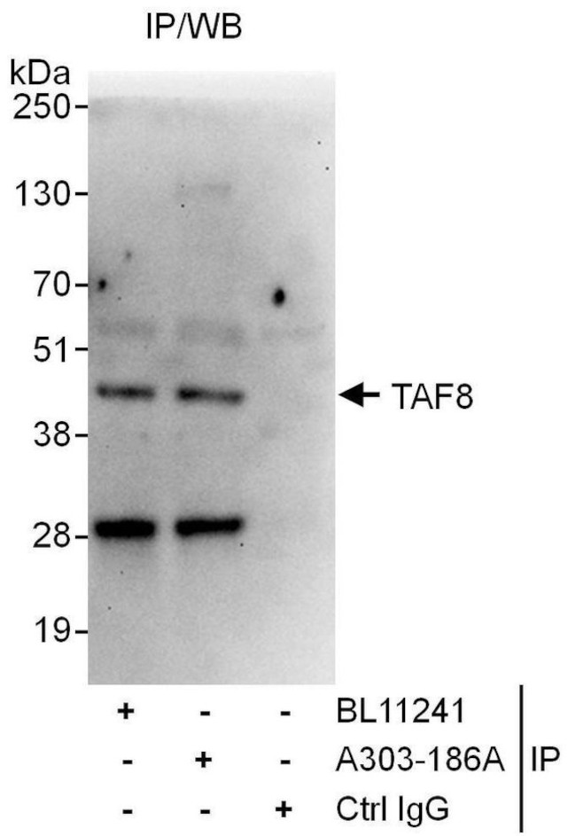 TAF8 Antibody in Immunoprecipitation (IP)