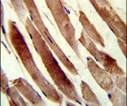 TAGLN Antibody in Immunohistochemistry (IHC)