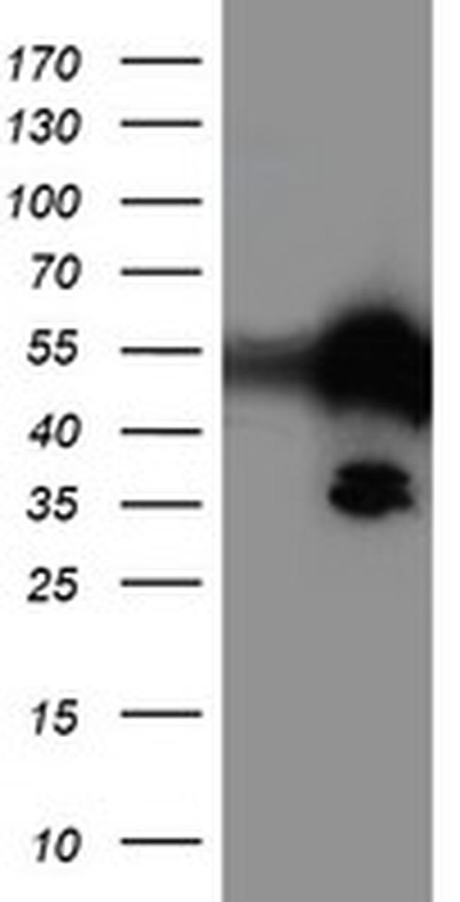 TAL1 Antibody in Western Blot (WB)