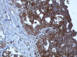 TAPBPL Antibody in Immunohistochemistry (Paraffin) (IHC (P))