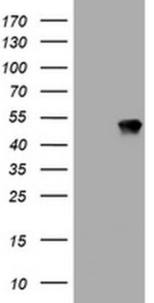 TAPBPL Antibody in Western Blot (WB)