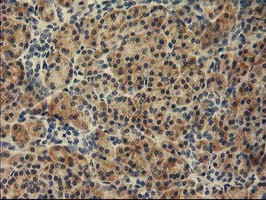 TBC1D21 Antibody in Immunohistochemistry (Paraffin) (IHC (P))