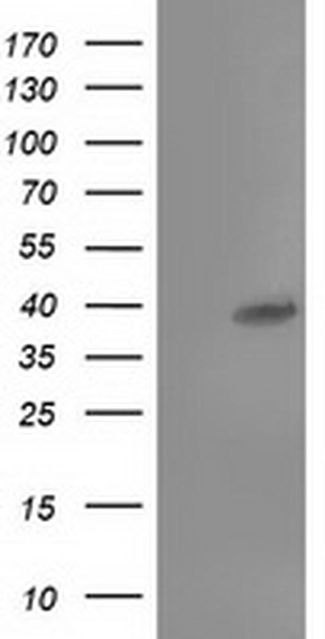 TBC1D21 Antibody in Western Blot (WB)