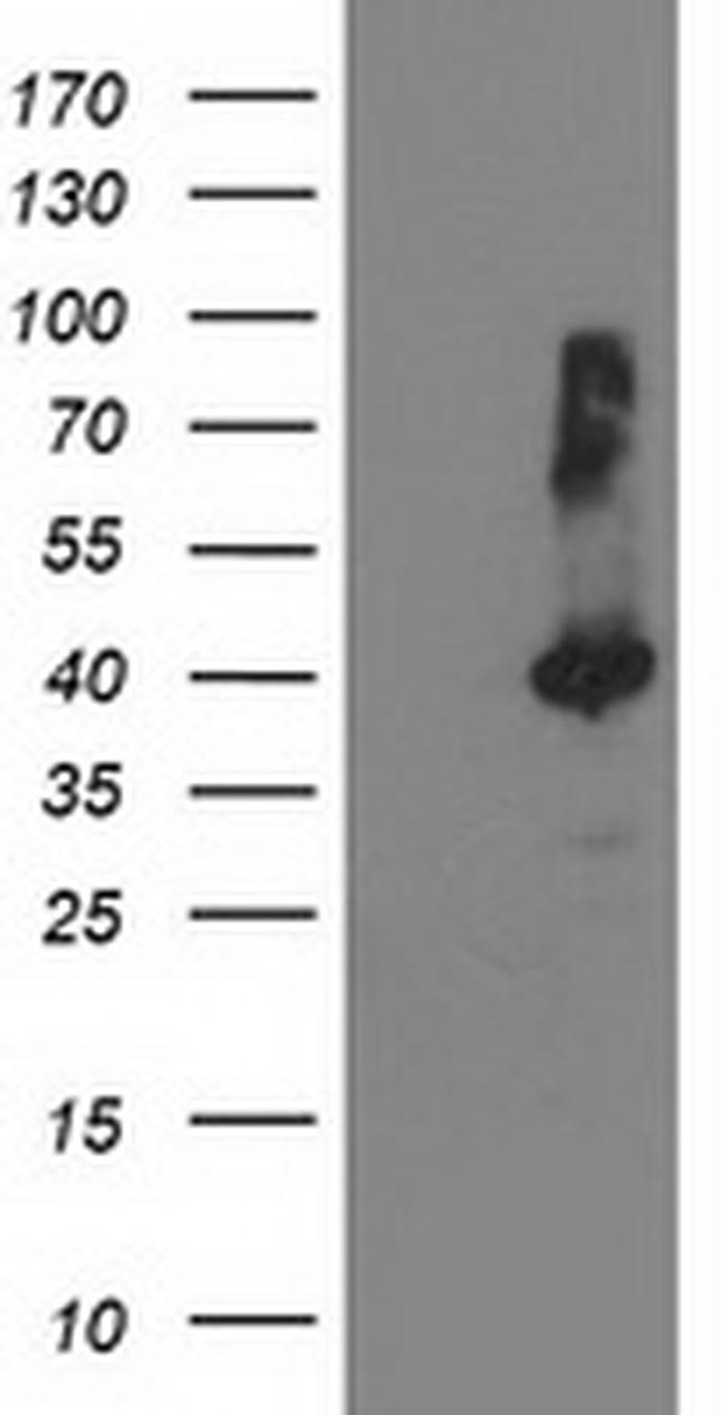 TBC1D21 Antibody in Western Blot (WB)