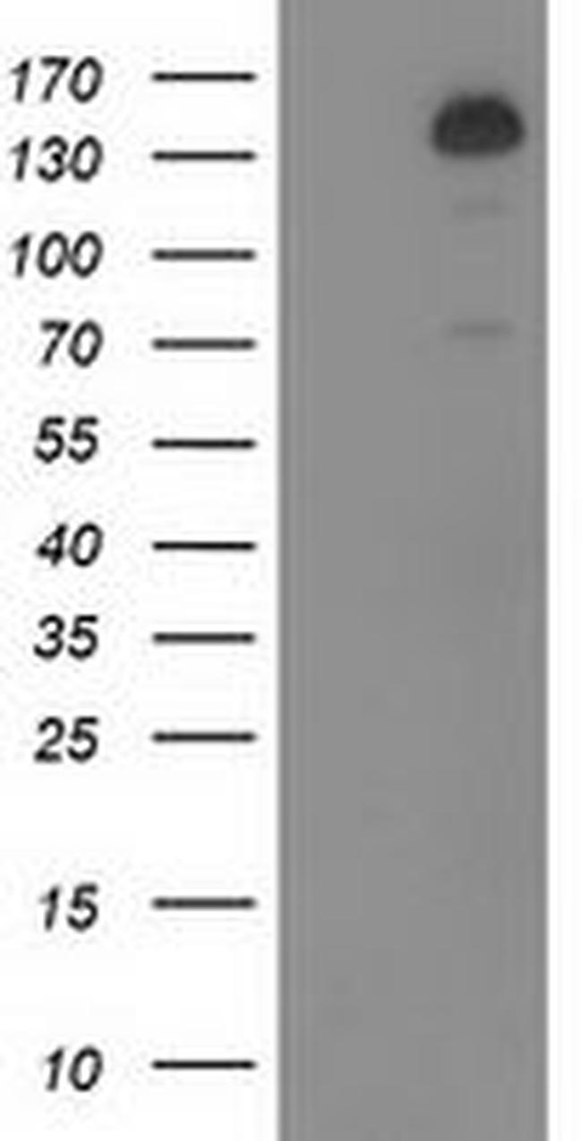 TBC1D4 Antibody in Western Blot (WB)