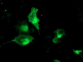 TBCC Antibody in Immunocytochemistry (ICC/IF)