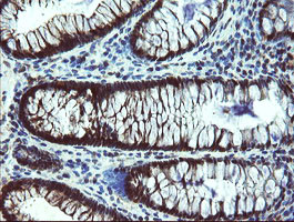 TBCC Antibody in Immunohistochemistry (Paraffin) (IHC (P))